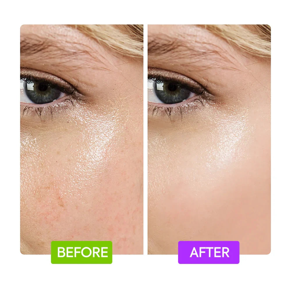 AHA Resurfacing Serum with Glycolic and Lactic Acid