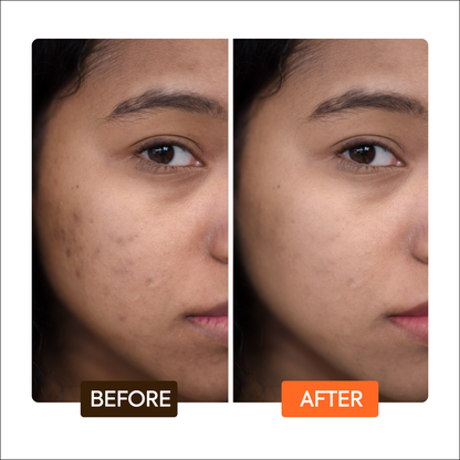 Extreme Active Intense Tone Boosting Face cream Duo