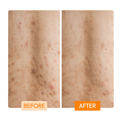 GLYCOLIC + LACTIC ACID + NIANCINIMIDE  BODY WASH