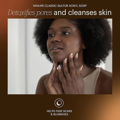 Acne Sulphur Soap detoxifies pores and controls oil