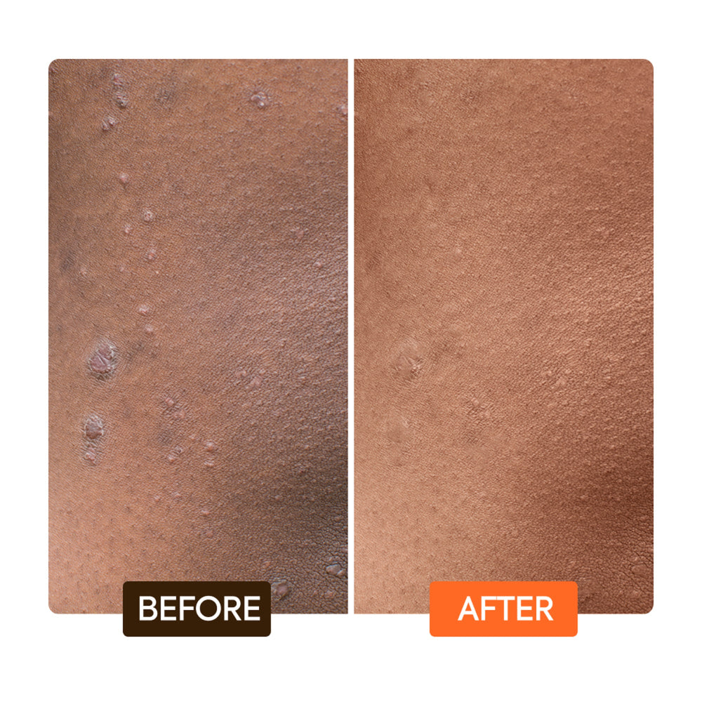 Carrot Toning Glycerin helps fade stretch marks