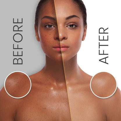 Makari Multi-action Extreme Toning Face Cream Spf 15